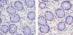 THRB Antibody in Immunohistochemistry (Paraffin) (IHC (P))