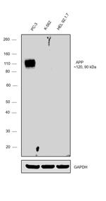 beta Amyloid Antibody in Western Blot (WB)