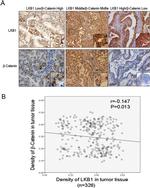 beta Catenin Antibody in Immunohistochemistry (IHC)