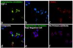 Calprotectin Antibody