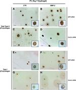 Collagen II Antibody in Immunohistochemistry (IHC)