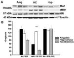 Glucocorticoid Receptor Antibody in Western Blot (WB)