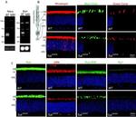 GRK1 Antibody in Immunohistochemistry (IHC)