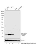 Calprotectin Antibody in Western Blot (WB)