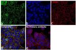 IGF1R alpha Antibody in Immunocytochemistry (ICC/IF)