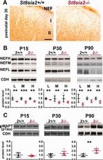 N-cadherin Antibody in Western Blot (WB)