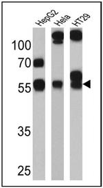 CYP3A7 Antibody in Western Blot (WB)
