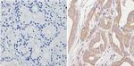 SPTBN1 Antibody in Immunohistochemistry (Paraffin) (IHC (P))