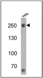 SPTBN1 Antibody in Western Blot (WB)