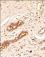 BRIP1 Antibody in Immunohistochemistry (Paraffin) (IHC (P))