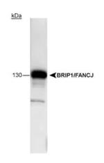 BRIP1 Antibody in Western Blot (WB)