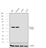 Vimentin Antibody