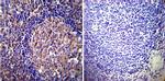 Vimentin Antibody in Immunohistochemistry (Paraffin) (IHC (P))