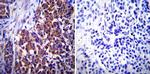 Vimentin Antibody in Immunohistochemistry (Paraffin) (IHC (P))