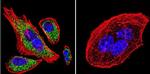 SERCA2 ATPase Antibody in Immunocytochemistry (ICC/IF)