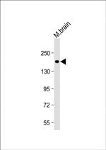 LRRK2 Antibody in Western Blot (WB)