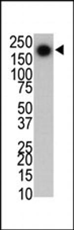 LRRK2 Antibody in Western Blot (WB)