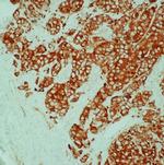 HSP27 Antibody in Immunohistochemistry (IHC)