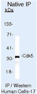 CDK5 Antibody in Immunoprecipitation (IP)