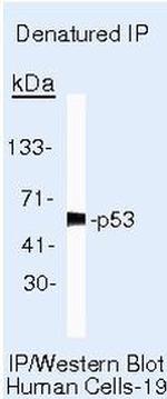 p53 Antibody in Immunoprecipitation (IP)