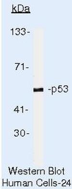 p53 Antibody in Western Blot (WB)