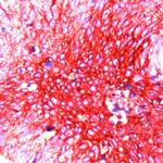 GLUT1 Antibody in Immunohistochemistry (IHC)