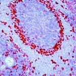 Fascin Antibody in Immunohistochemistry (Paraffin) (IHC (P))