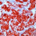 GnRHR Antibody in Immunohistochemistry (Paraffin) (IHC (P))