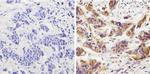 Survivin Antibody in Immunohistochemistry (Paraffin) (IHC (P))