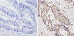 Survivin Antibody in Immunohistochemistry (Paraffin) (IHC (P))