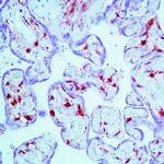 Factor XIII A Antibody in Immunohistochemistry (Paraffin) (IHC (P))