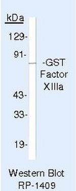 Factor XIII A Antibody in Western Blot (WB)