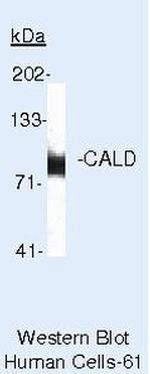 Caldesmon Antibody in Western Blot (WB)