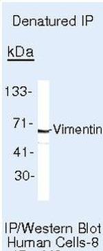Vimentin Antibody in Immunoprecipitation (IP)