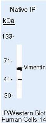 Vimentin Antibody in Immunoprecipitation (IP)
