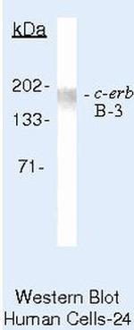 ErbB2 (HER-2) Antibody in Western Blot (WB)