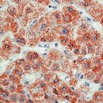 Mitochondria Antibody in Immunohistochemistry (Paraffin) (IHC (P))