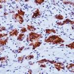 Thyroid Stimulating Hormone Antibody in Immunohistochemistry (Paraffin) (IHC (P))