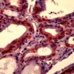 SLC5A5 Antibody in Immunohistochemistry (Paraffin) (IHC (P))