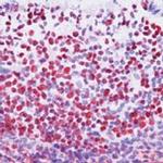 MCM2 Antibody in Immunohistochemistry (Paraffin) (IHC (P))