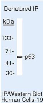 p53 Antibody in Immunoprecipitation (IP)