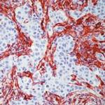 TGM2 Antibody in Immunohistochemistry (IHC)