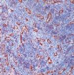 TGM2 Antibody in Immunohistochemistry (IHC)