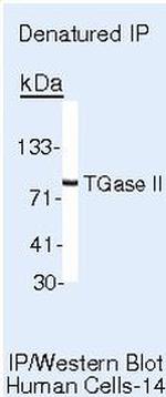 TGM2 Antibody in Immunoprecipitation (IP)