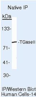 TGM2 Antibody in Immunoprecipitation (IP)