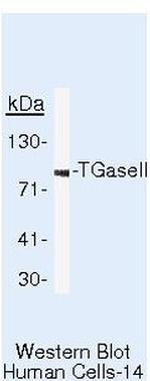 TGM2 Antibody in Western Blot (WB)