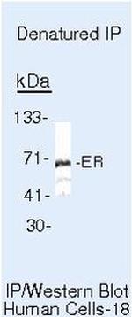 Estrogen Receptor alpha Antibody in Immunoprecipitation (IP)