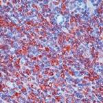 Syk Antibody in Immunohistochemistry (IHC)