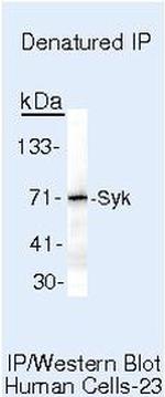 Syk Antibody in Immunoprecipitation (IP)