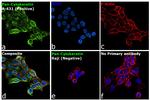 Cytokeratin Pan Antibody in Immunocytochemistry (ICC/IF)